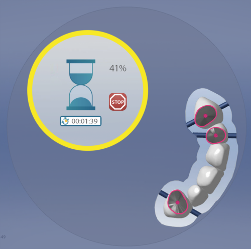 MB Timer added to calculation operations