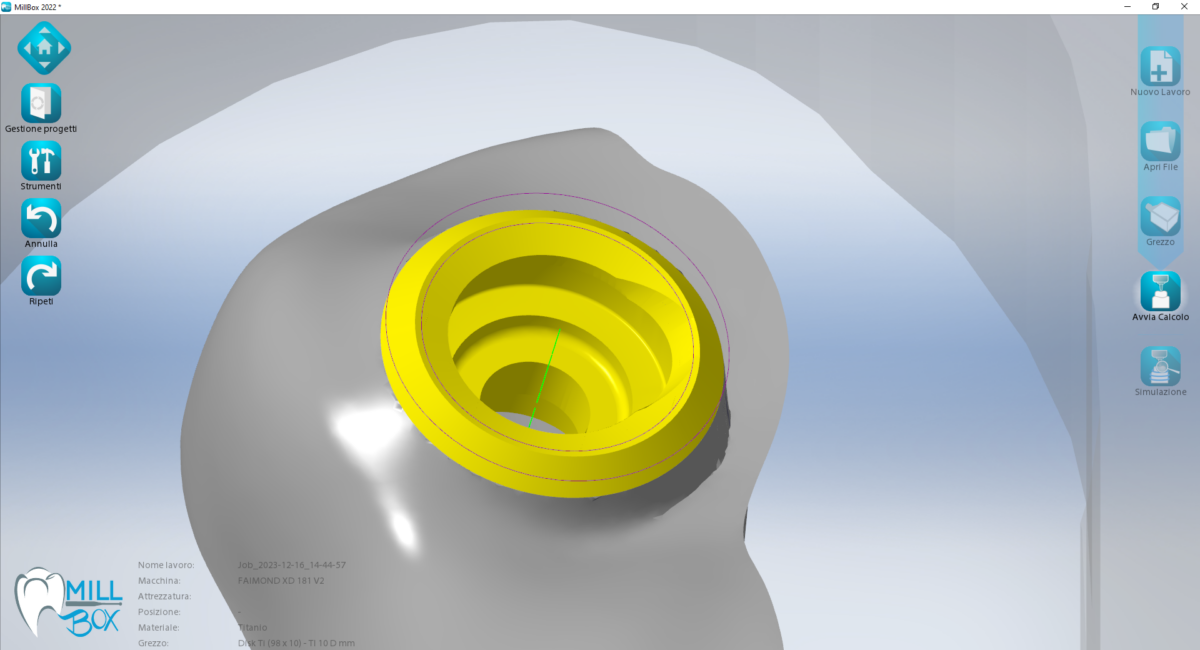 Scientific research has enabled major advances in implantology, such as the OT Bridge protocol, made from a series of innovative elements that can stabilize the prosthesis more while reducing the number of implanted screws.. Read more